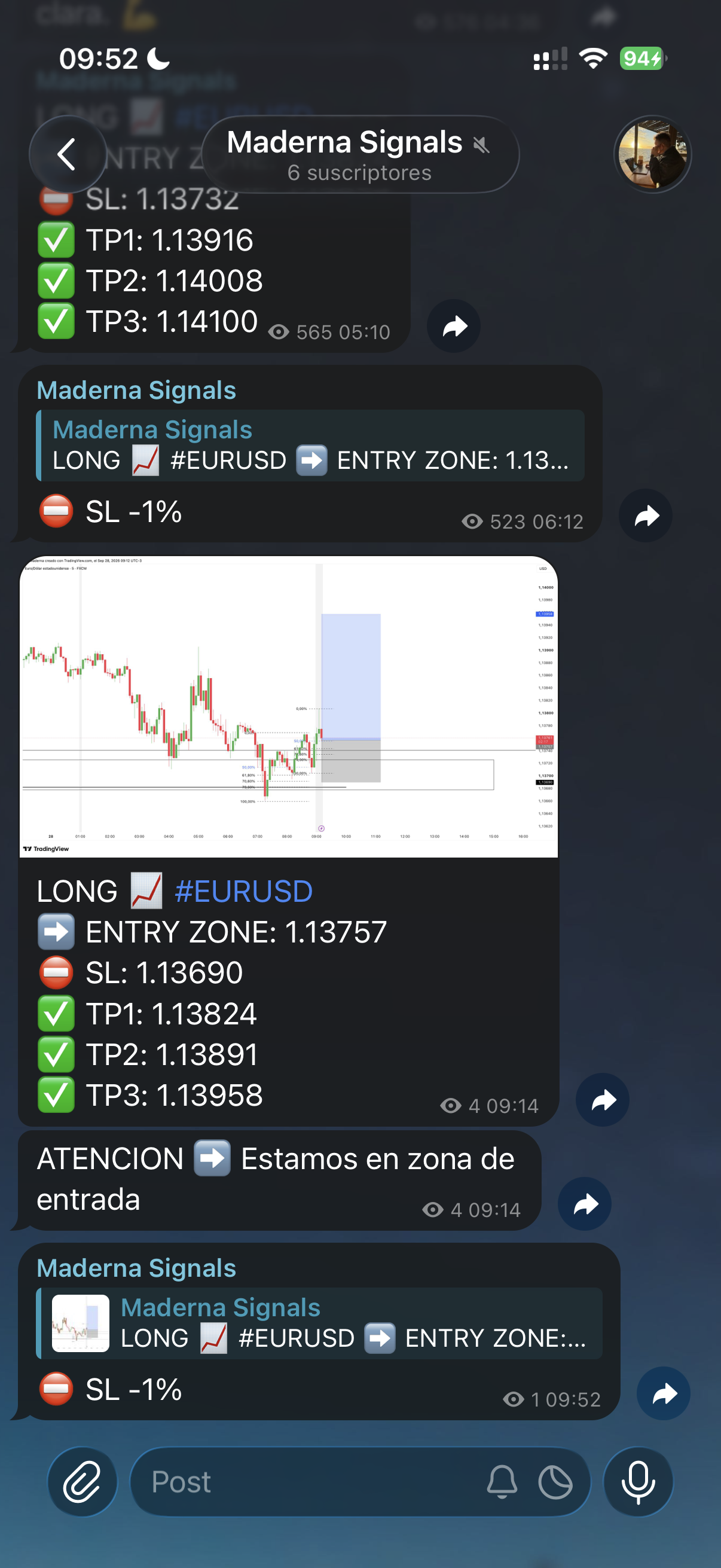 Captura de EURUSD 2026-09-28